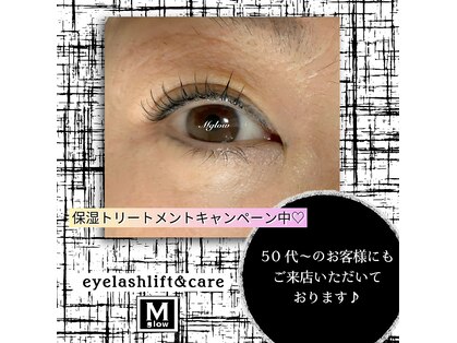 エムグロウ(Mglow)の写真