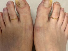 レイヴェンエーアール(Raven.AR)/BONDIST/トゥリング