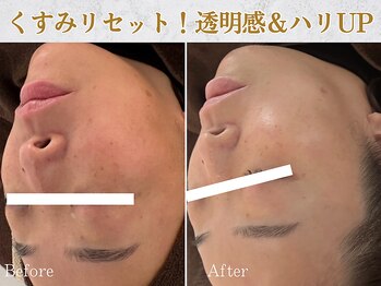 ぷるる 練馬 江古田/ララピールお試し7700円