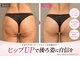 ソルツーサロン マナ(MANA)の写真/太もも~ヒップまで★大人の気になる「後ろ姿」を集中ケア
