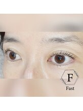 アイラッシュサロン ファスト(Fast)/次世代まつげパーマ