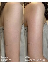 フロル(FLOR)/FLOR【根本改善専門店】