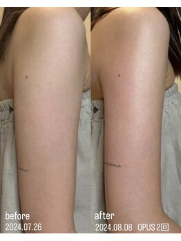 フロル(FLOR)/FLOR【根本改善専門店】