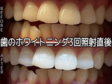 ヴィオール 名古屋栄店(VIOR)/都度払い　ホワイトニング