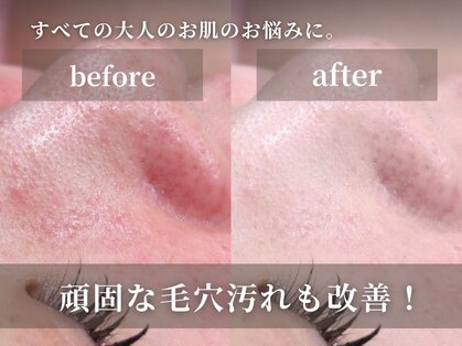 キャロリーヌ 大宮店の写真