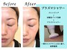 【初回限定◆肌質改善・ニキビ悩みに】プラズマシャワー♪