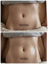 ラプタス(Rapu+)/何歳でもビキニが似合うくびれに