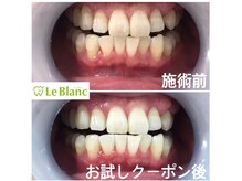 ルブラン 奈良店(Le Blanc)/不潔に見られないように。。