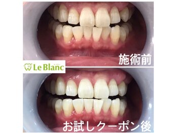 ルブラン 奈良店(Le Blanc)/不潔に見られないように。。