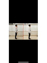 東洋カイロプラクティック麻布十番療術センター/施術の前後の変化の比較