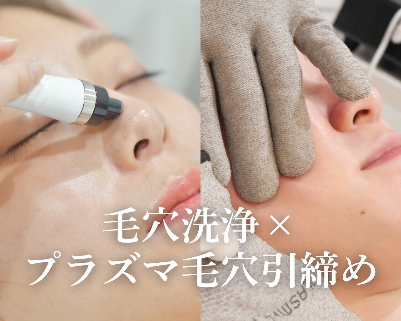 キーオブフェイス(Key of Face)｜ホットペッパービューティー