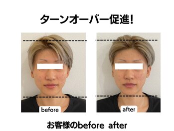 マーキュリー(Mercury)/美容鍼灸のお客様