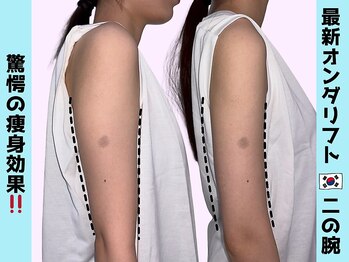 カンナムビューティー 福岡天神店/オンダリフト/福岡/ララピール