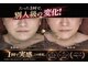ティースキンサロンオキナワ(T-skin salon Okinawa)の写真/変化にびっくり！話題のマシン筋膜リリース&小顔リンパで一度で実感する小顔+美肌ケア！鏡を見たくなる顔へ
