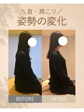 アオ 香椎(AO)/before→after