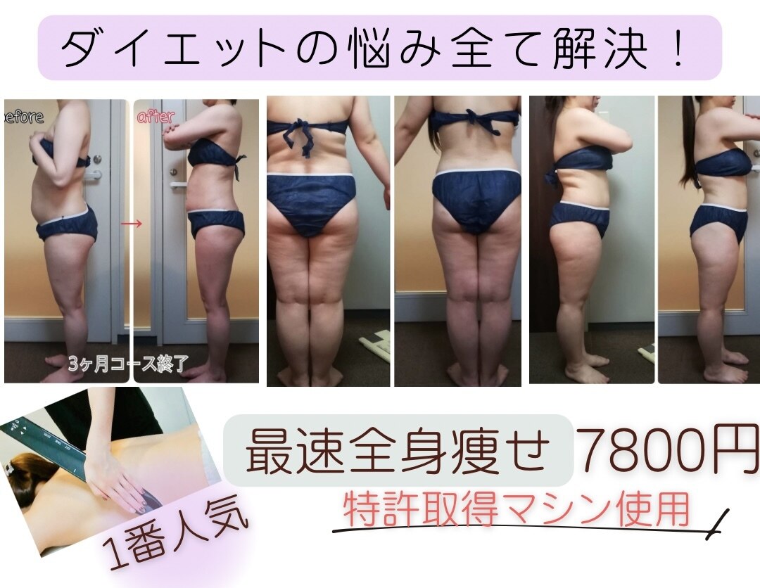 ダイエット サポート(DIET SUPPORT)｜ホットペッパービューティー