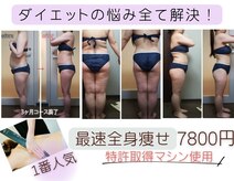 ダイエット サポート(DIET SUPPORT)