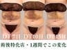 【術後ケア】インディバ70分◆腫れ/内出血/固さ DT緩和ケア ￥13000→