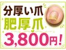 分厚い爪１枚【伸びない爪！諦めないで】改善♪9800→3800