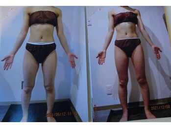 パーフェクトボディプレミアム 大阪梅田店(PERFECT BODY PREMIUM)/お客様 ビフォーアフター(17)