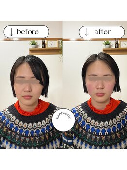 ハリボケア 葛西(haribo care)/小顔矯正