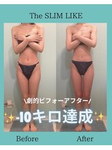 スリムライク 鳥取店(The SLIM LIKE)/痩身ビフォーアフター