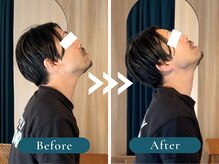 リリーフポート 大手町店/施術での結果