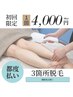 お好きな3箇所脱毛★腕やうなじ脱毛など気になるところだけ♪¥5000→¥4000