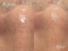 ケアナ 麻布十番店(CareNa)/毛穴を制して美肌を制す！