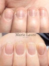 マリーロール 淀屋橋本店(Marie Laure)/自爪育成/深爪矯正/ネイルケア