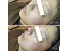 ピエル 北千住店(PIEL)/只今お得なキャンペーン期間中