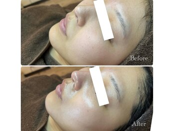 ピエル 北千住店(PIEL)/只今お得なキャンペーン期間中