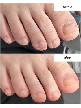 ケアプラス(care plus)/フットネイルケア