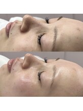 デイジー バイ アルテフィーチェ 梅田(daisy by artefice)/フェイスワックスでトーンアップ