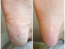 リゼラアンドコー 浦安店/ドイツ式フットケア専門店