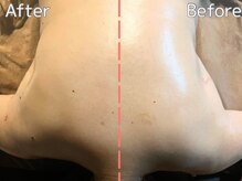 デイジー(Daisy)/〈50代女性〉肩甲骨/肩こり/整体