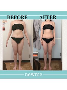 ニュウミー 諏訪本店(newme)/お客様ビフォーアフター