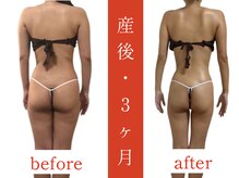 ウィズルーチェ 神栖店(with luce)/産後痩身効果★痩せない身体に