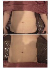 マハロ スコータイ/ビフォーアフター　＜お腹＞