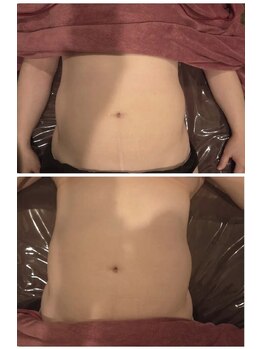 マハロ スコータイ/ビフォーアフター　＜お腹＞