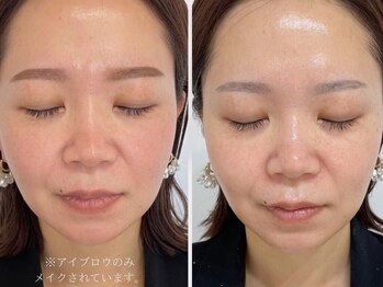 ザ ヴォーグ(the VOGUE)/セルマン｜ツヤ、肌質改善