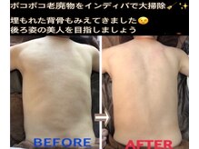 アルページュ(Arpege)の雰囲気（お背中.首肩周りを深部加温♪呼吸を深く睡眠の質改善、代謝UPへ）
