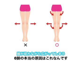 タスク整体院 磐田店/O脚の本当の原因