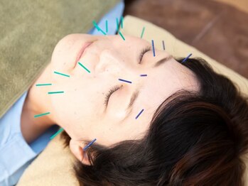 スクナビコナ鍼灸院の写真/血行を促進させ、すっきりとした小顔とほっそりとした首を実現☆お顔のくすみや乾燥にお悩みの方も◎