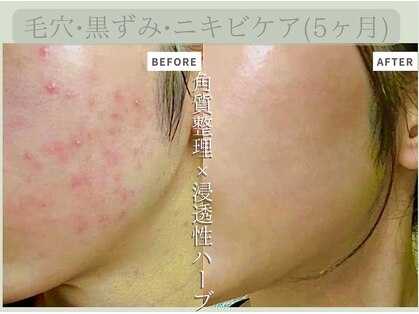 ルミエール パークサイド(L’MIERE parkside)の写真