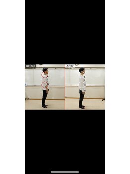 東洋カイロプラクティック麻布十番療術センター/姿勢改善による体の変化(側面)