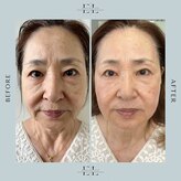 アルティ バイ ドルチェ(Ulti by dolce)