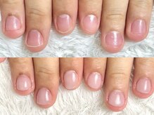 深爪矯正 爪悩み専門店 グラシナ 西宮北口店【4/3 NEW OPEN（予定）】/(深爪/長さだし/フィルイン)