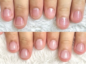 深爪矯正 爪悩み専門店 グラシナ 西宮北口店【4/3 NEW OPEN（予定）】/(深爪/長さだし/フィルイン)