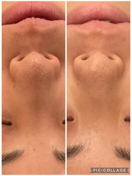 リノ 西宮北口店(Lino)/